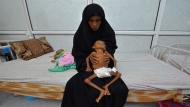 الأمم المتحدة: ثلث محافظات اليمن على شفير المجاعة