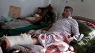 AP  آلاف من القتلى والمصابين في اليمن جراء الحرب الدائرة 