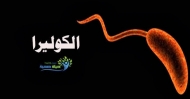 ظهور 3 إصابات بمرض الكوليرا بصنعاء