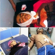 قتلى في تعز جراء قصف المليشيات الاحياء السكنية اليوم الاثنين