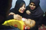 طفلة من عدن قتلت على يد احد قناصة مليشيات صالح والحوثي