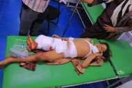 أحد الأطفال المصابين بالقصف الحوثي على حي المطار في تعز مطلع الأسبوع الجاري